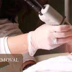 LASER HAIR REMOVAL 750