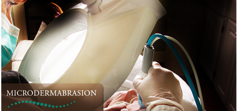 Microdermabrasion SimplySmooth Hair Removal Experts in